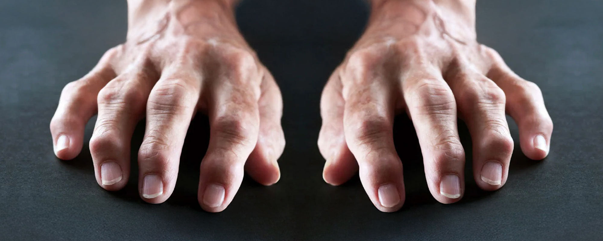 Is BJJ Linked with Arthritis?